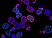 national-cancer-institute-L7en7Lb-Ovc-unsplash